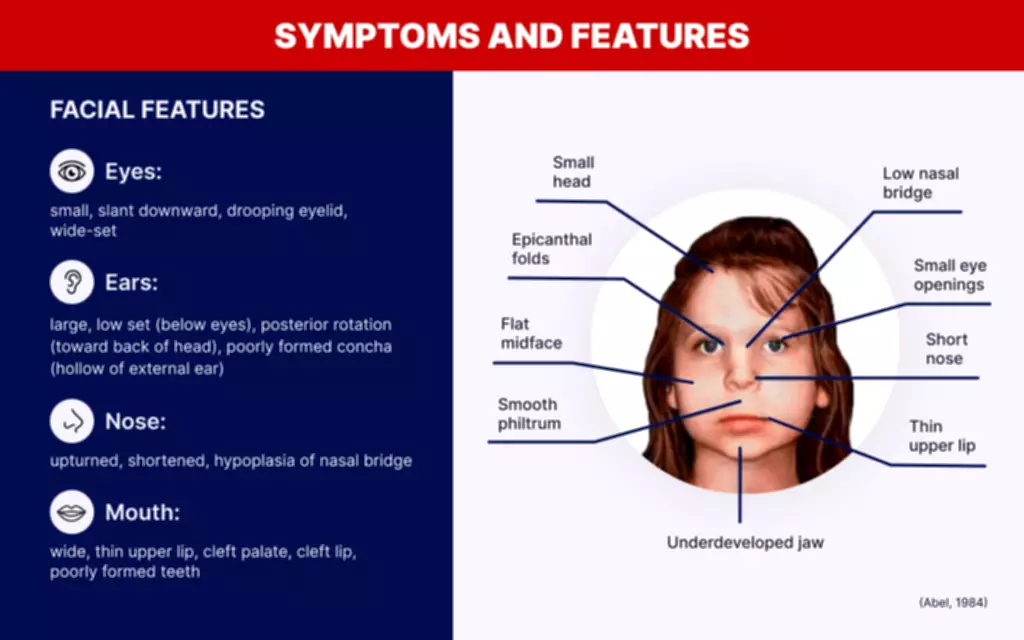 fentanyl poisoning